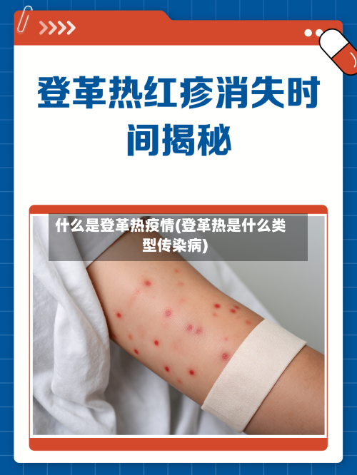 什么是登革热疫情(登革热是什么类型传染病)-第3张图片